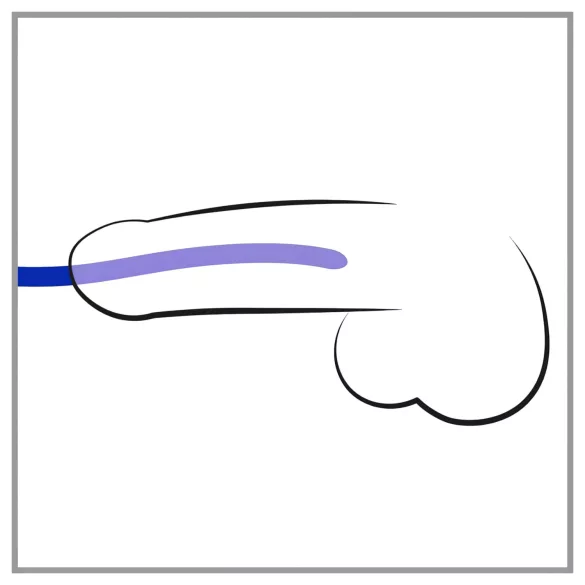 You2Toys - dilatátor - silikónová sada (3 ks)