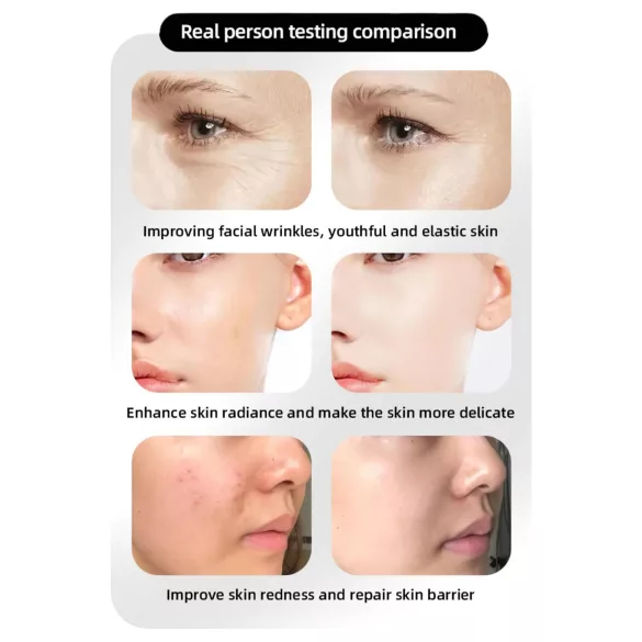 Photonové omladzujúce LED maska na tvár